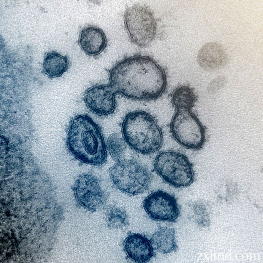 显微镜下的新型冠状病毒COVID-19图片