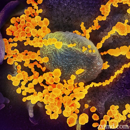 显微镜下的新型冠状病毒covid19图片