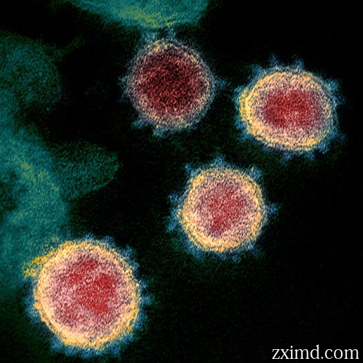 显微镜下的新型冠状病毒COVID-19图片